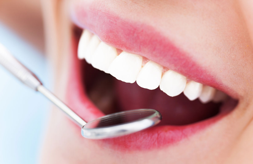 Should I Get Dental Insurance? Is it worth it?